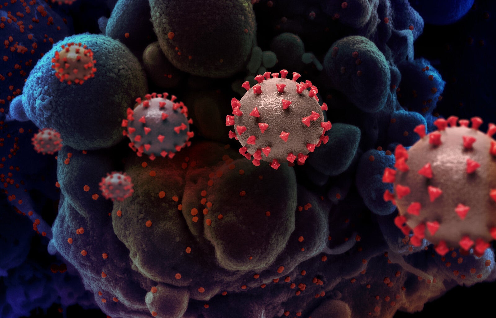 covid-19 virus