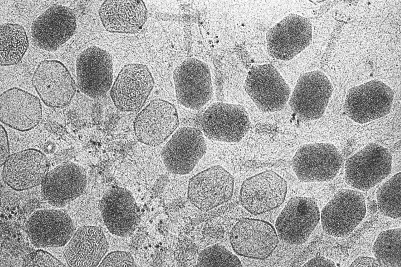 bacteria cells