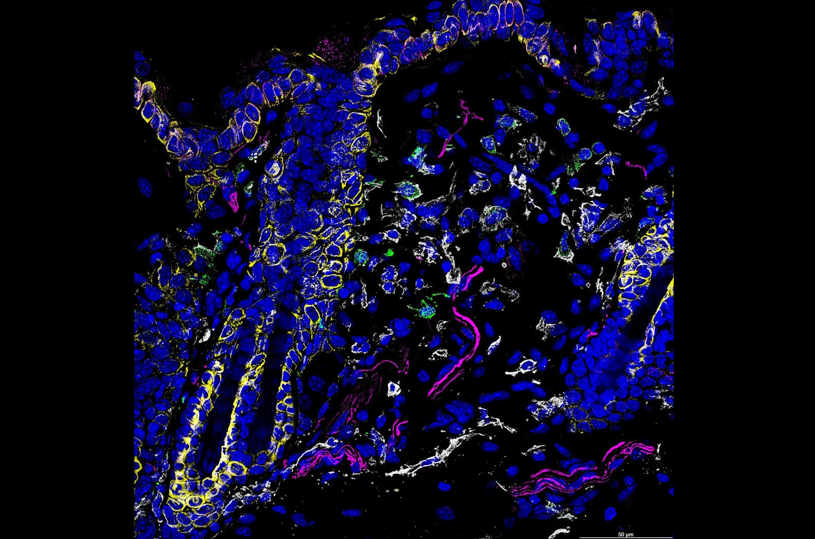 science of itch microscopic image